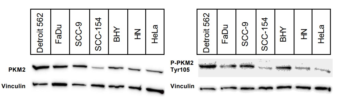 Western blots of PKM or P-PKM2.jpg
